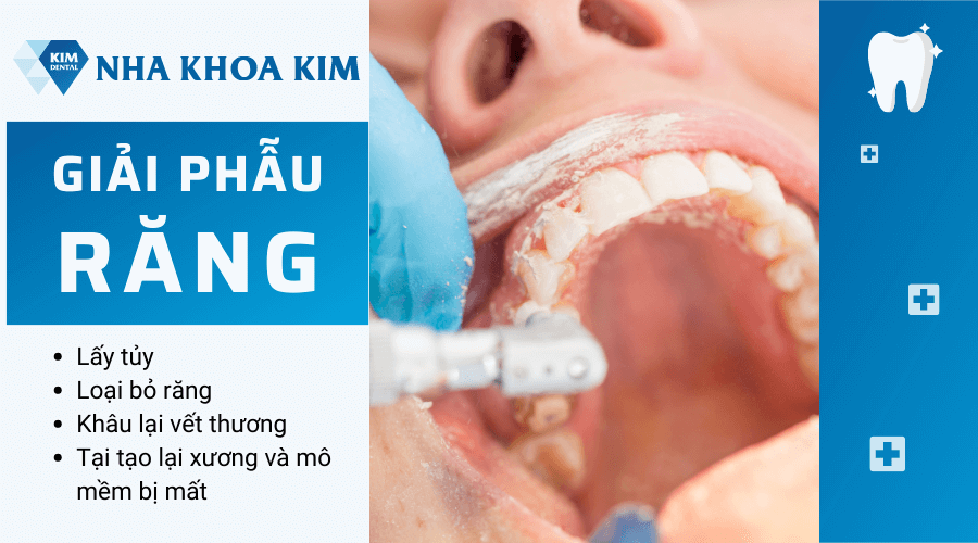 Giải phẫu răng là gì