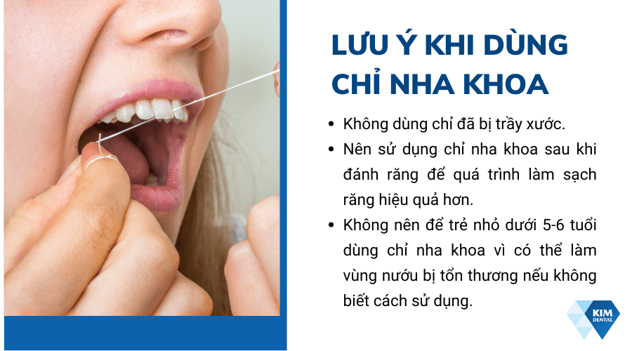 Lưu ý khi sử dụng chỉ nha khoa