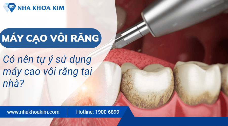 Có cần kiến thức nha khoa để tự lấy cao răng tại nhà? 
