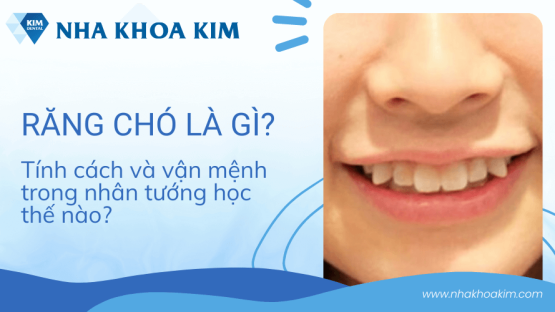 Răng chó là gì? Tính cách và vận mệnh trong nhân tướng học thế nào?