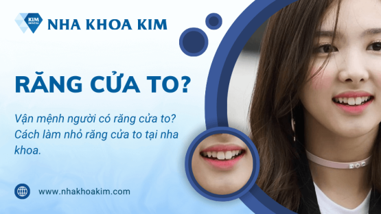 Vận mệnh người có răng cửa to? Cách làm nhỏ răng tại nha khoa