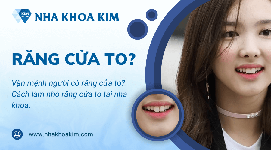 Vận mệnh người có răng cửa to? Cách làm nhỏ răng cửa to tại nha khoa