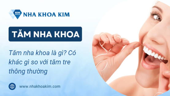 Tăm nha khoa là gì? Có khác gì so với tăm tre thông thường