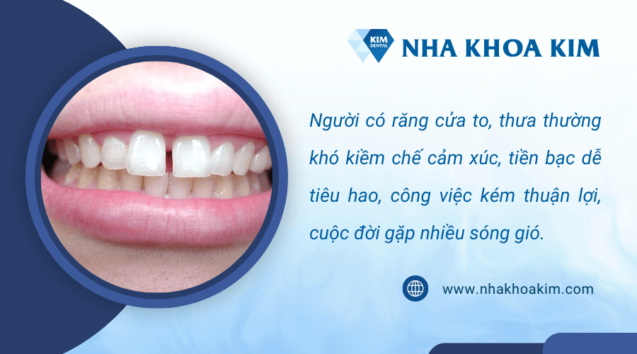 Vận mệnh người có răng cửa to