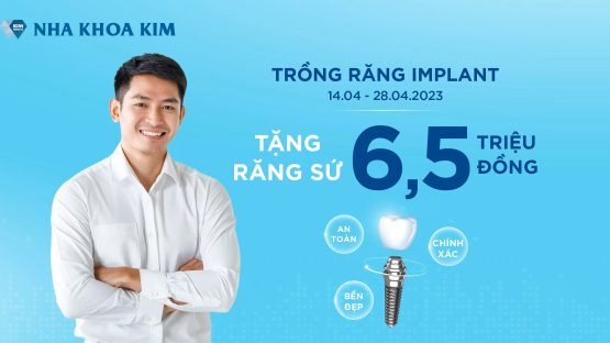 TRỒNG RĂNG IMPLANT AN TOÀN, CHÍNH XÁC, BỀN ĐẸP VỚI ƯU ĐÃI HẤP DẪN