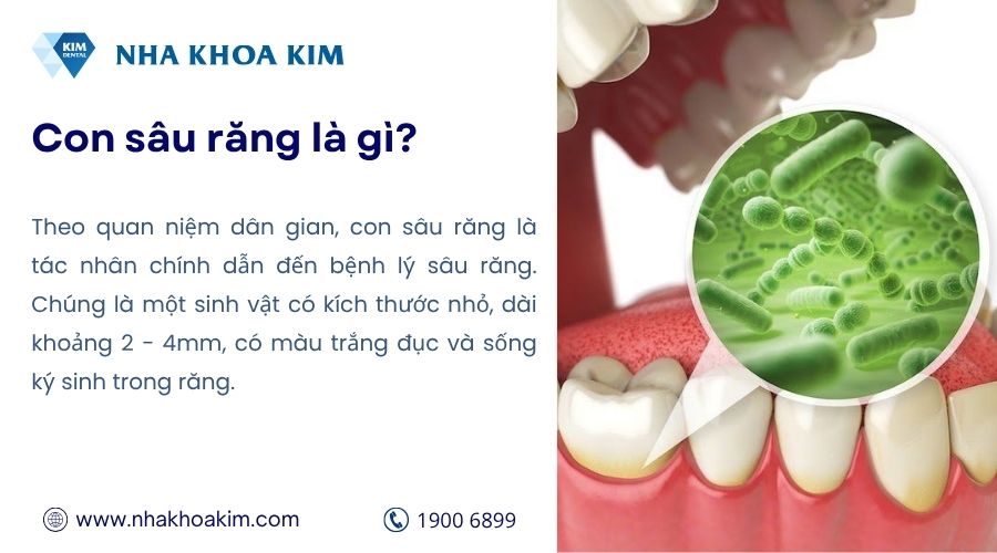 Con sâu răng là gì?