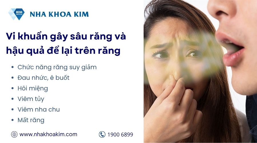 Vi khuẩn gây sâu răng và hậu quả để lại trên răng