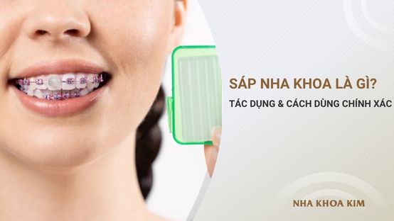 Sáp nha khoa là gì? Tác dụng và cách dùng chính xác