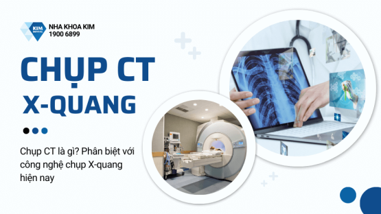 Chụp CT là gì? Phân biệt với công nghệ chụp X-quang hiện nay