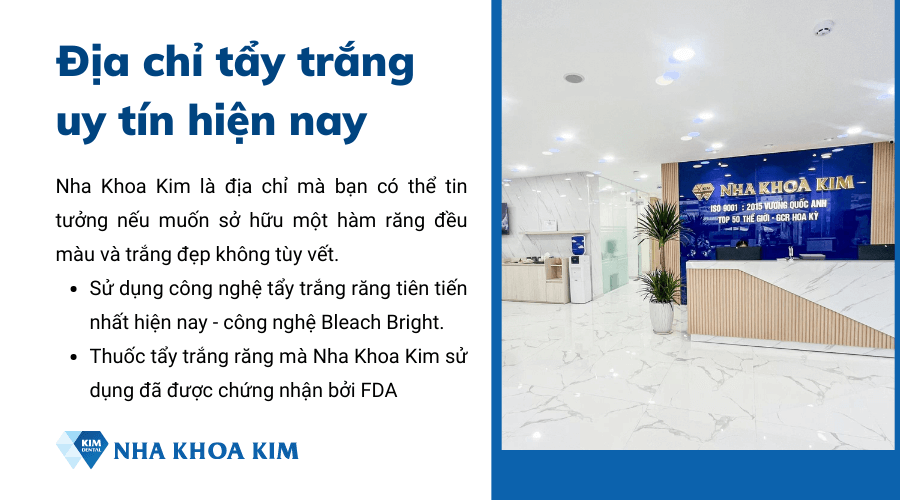 Mách bạn địa chỉ tẩy trắng răng uy tín hiện nay