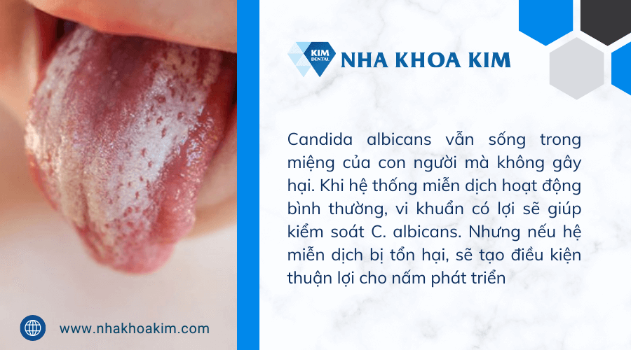 Nguyên nhân của bệnh nấm lưỡi