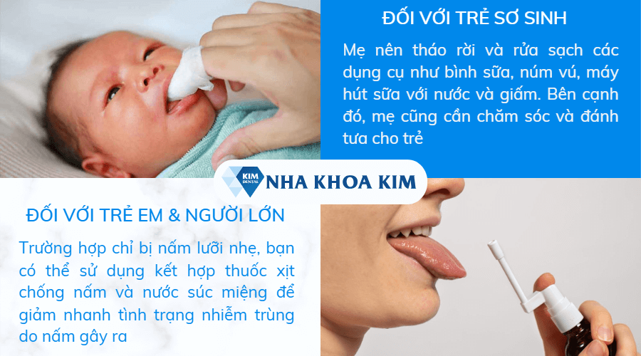 Điều trị bệnh nấm lưỡi ở người lớn và trẻ em