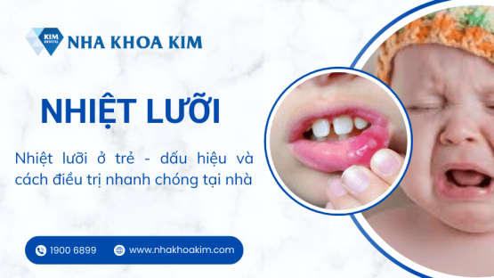 Nhiệt lưỡi ở trẻ – dấu hiệu và cách điều trị nhanh chóng tại nhà