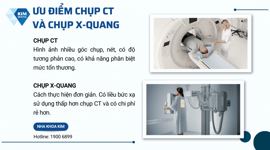 Đánh giá ưu nhược điểm của chụp CT và chụp X-quang