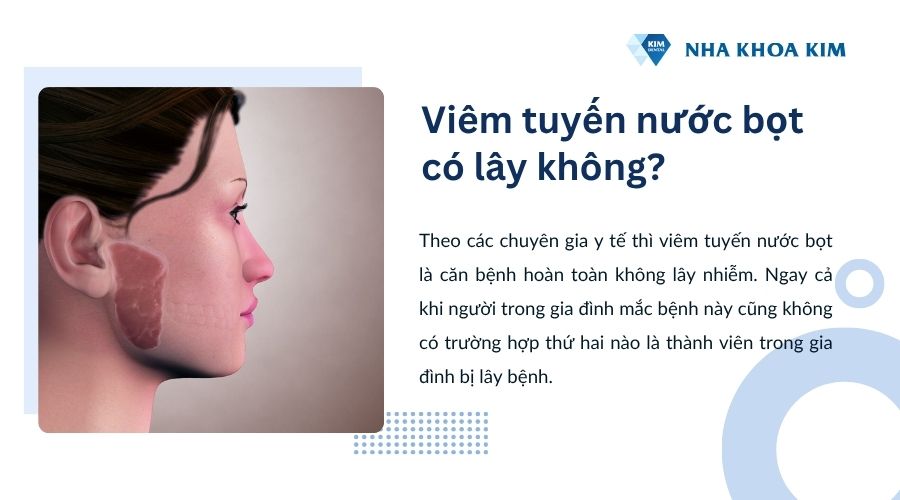 Viêm tuyến nước bọt có lây không?