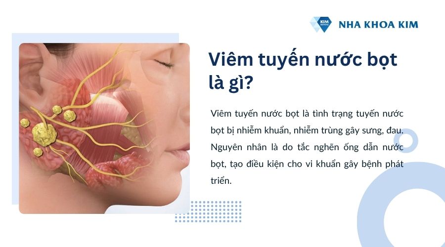 Viêm tuyến nước bọt là gì?
