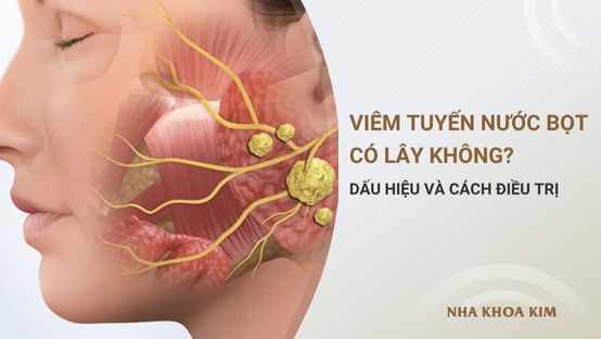 Viêm tuyến nước bọt có lây không? Dấu hiệu nhận biết và cách điều trị