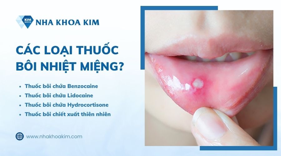 có mấy loại thuốc bôi nhiệt miệng?