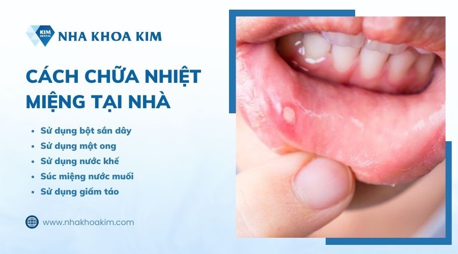các phương pháp chữa nhiệt miệng tại nhà