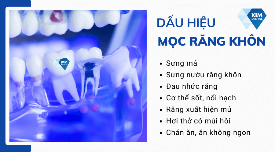 Dấu hiệu mọc răng khôn