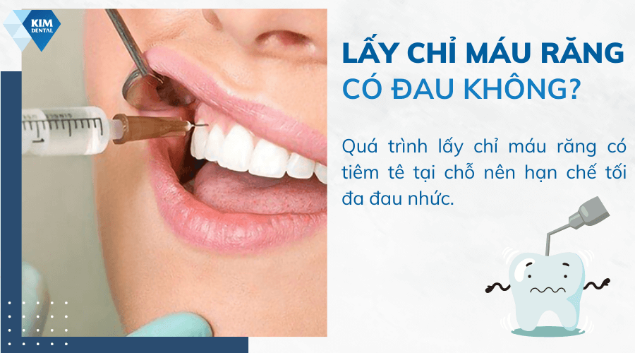 Lấy chỉ máu răng có đau không?