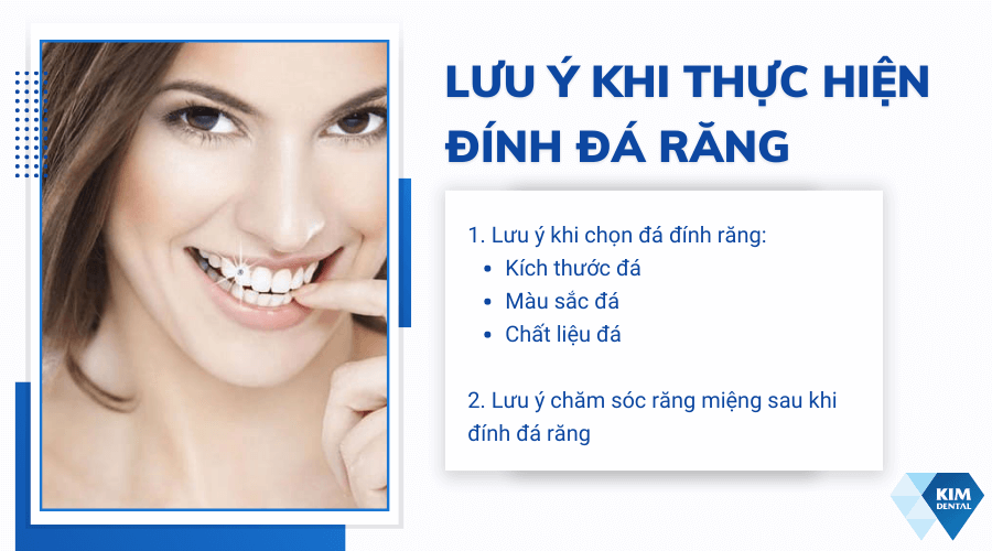 Lưu ý gì khi thực hiện gắn đá quý