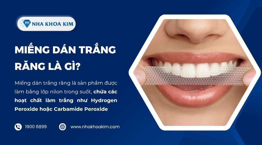 Miếng dán trắng răng là gì?