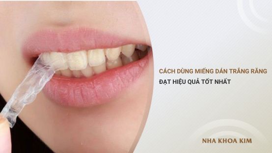 Cách dùng miếng dán trắng răng đạt hiệu quả tốt nhất