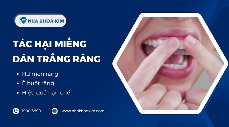 Tác hại của miếng dán trắng răng