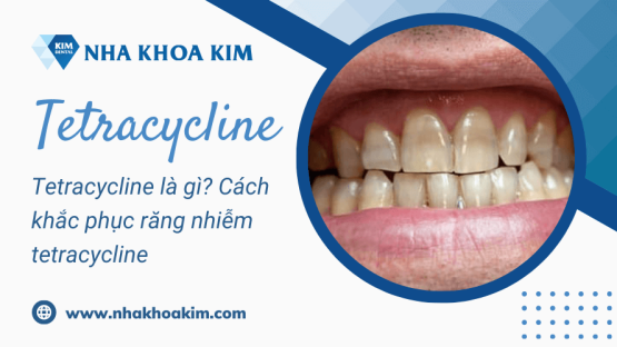 Tetracycline là gì? Cách khắc phục răng nhiễm tetracycline