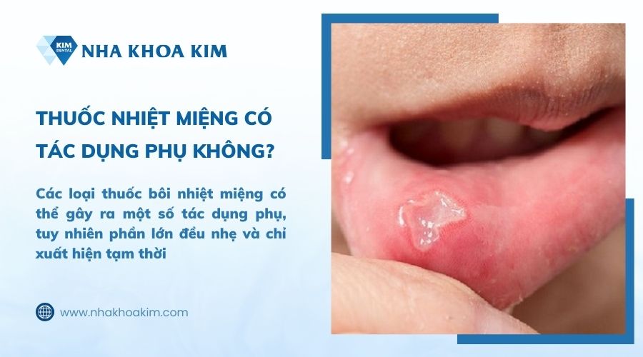 thuốc điều trị nhiệt miệng có tác dụng phụ không
