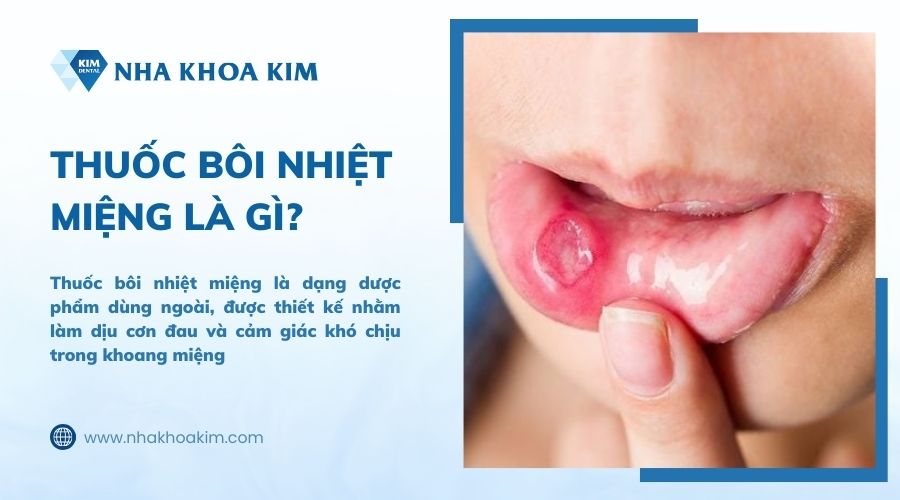 thuốc bôi nhiệt miệng là gì?