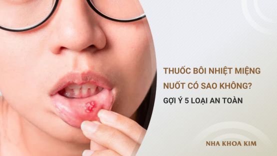 Thuốc bôi nhiệt miệng nuốt có sao không? 5 loại thuốc an toàn