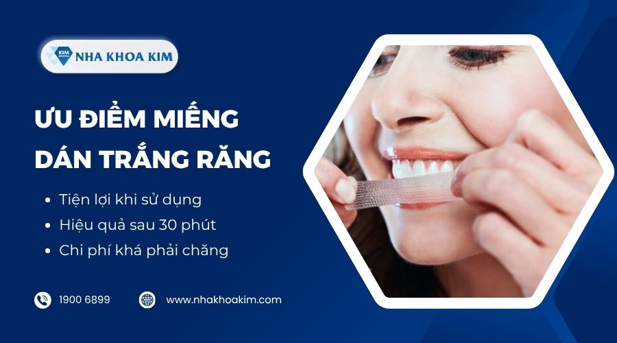 Ưu điểm của miếng dán trắng răng