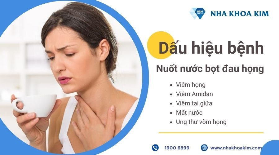 nuốt nước bọt đau họng là dấu hiệu của bệnh gì
