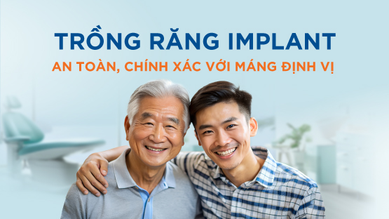 Trồng Răng Implant An Toàn Chính Xác Với Máng Định Vị