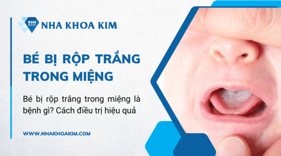 Bé bị rộp trắng trong miệng là bệnh gì? Cách điều trị hiệu quả