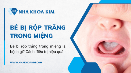 Bé bị rộp trắng trong miệng là bệnh gì? Cách điều trị hiệu quả