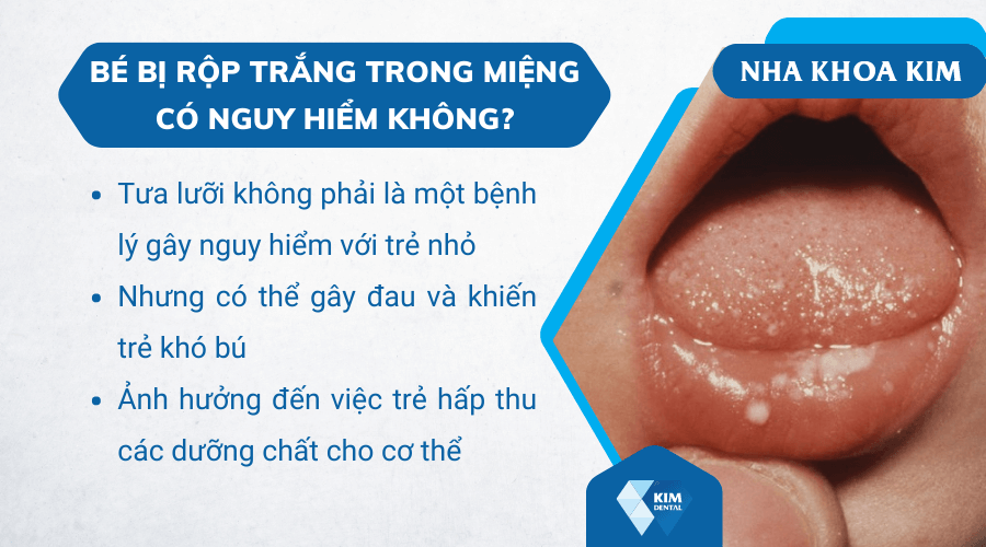 Bé bị rộp trắng trong miệng có nguy hiểm không?