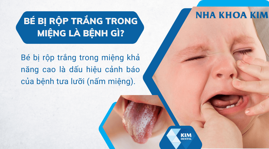 7. Tầm soát và phòng ngừa bệnh ROP