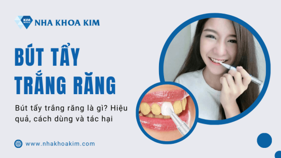 Bút tẩy trắng răng là gì? Cách sử dụng bút làm trắng răng