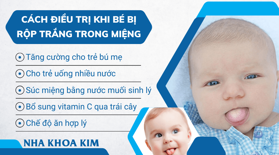 Cách điều trị khi bé bị rộp trắng trong miệng