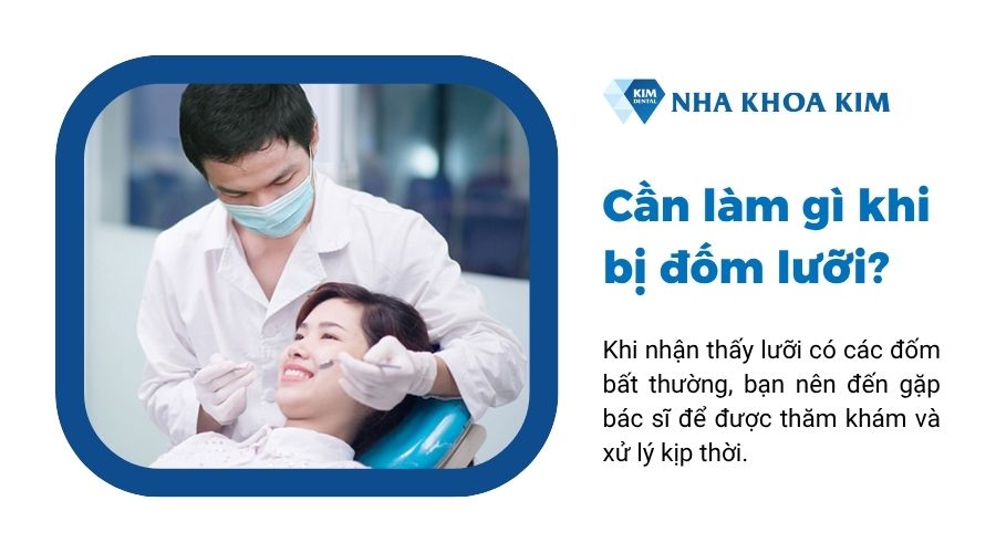 Cần làm gì khi bị đốm lưỡi