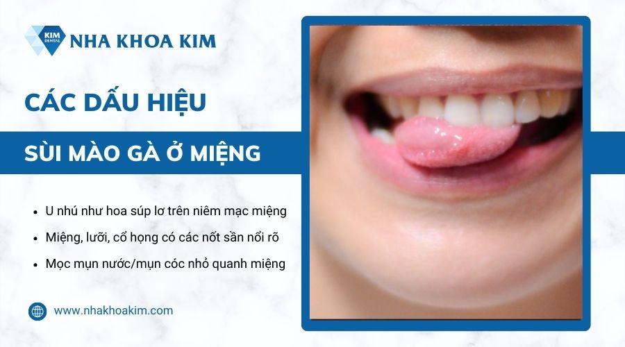 dấu hiệu sùi mào gà ở miệng