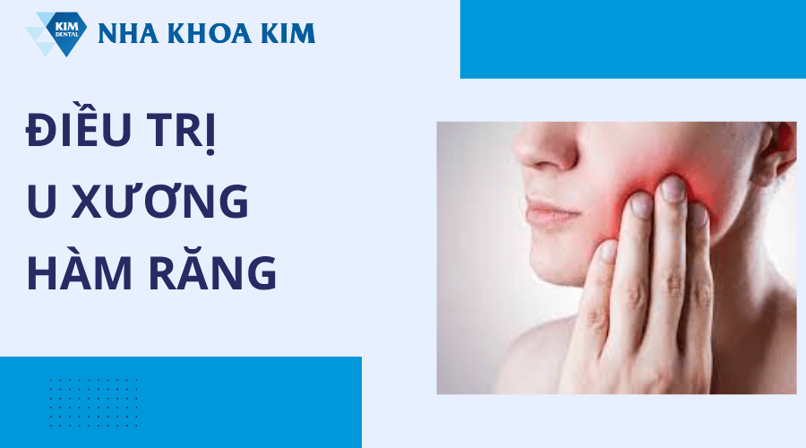 Điều trị u xương hàm