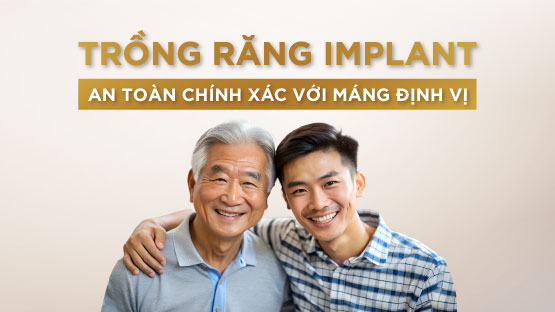 Trồng Răng Implant An Toàn Chính Xác Với Máng Định Vị 3D