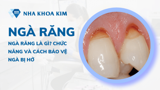 Ngà răng là gì? Chức năng và cách bảo vệ ngà bị hở