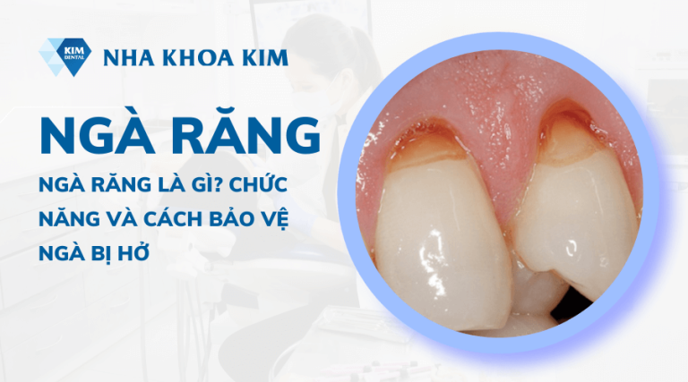 Ngà răng là gì? Chức năng và cách bảo vệ ngà bị hở