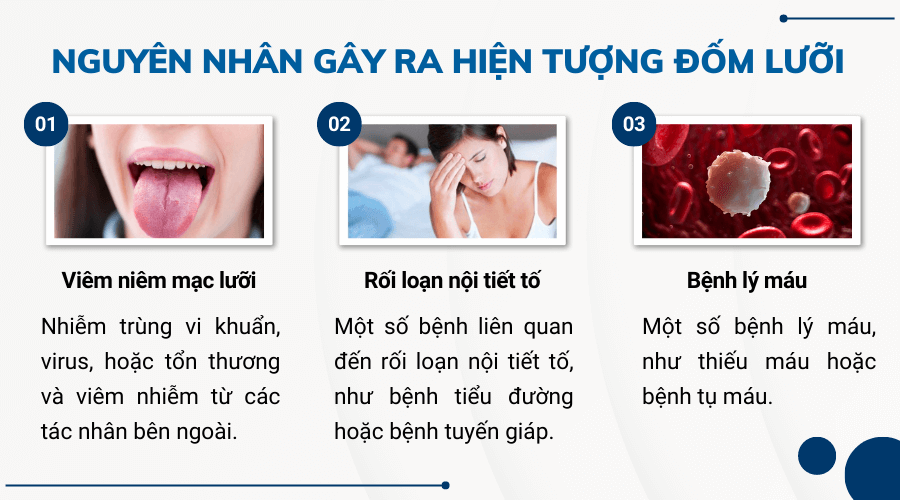 Nguyên nhân gây ra hiện tượng đốm lưỡi 