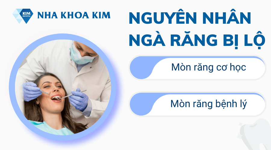 Nguyên nhân khiến ngà răng bị lộ